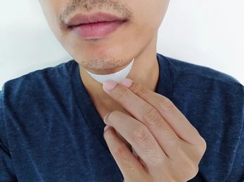 Chin Implant